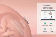 产科科普：妊娠合并症孕妇居家胎心监护分析